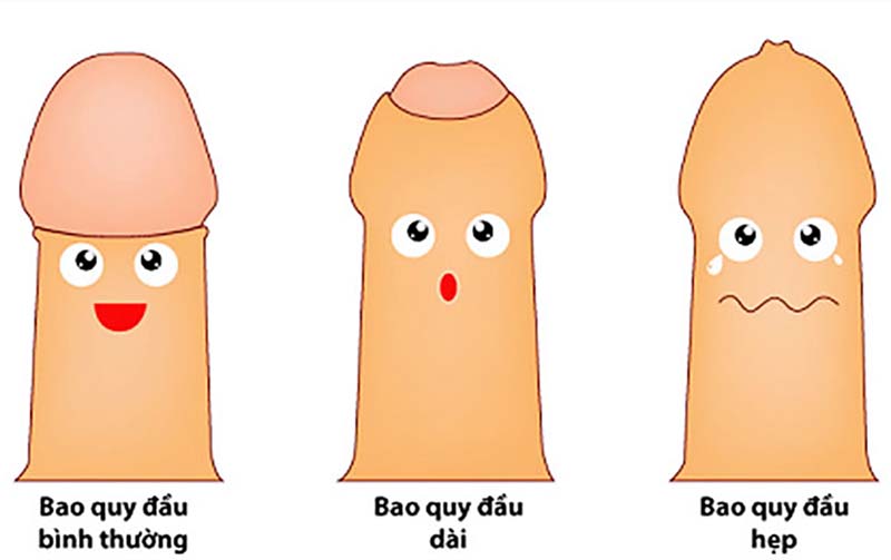 Dài bao quy đầu là gì?