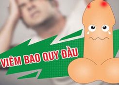 Cách chữa viêm bao quy đầu nào hiệu quả tốt