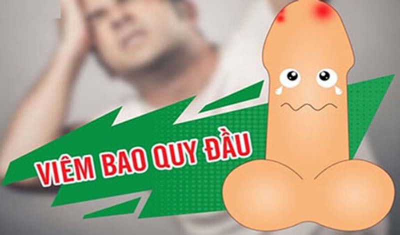 Viêm bao quy đầu là gì? 