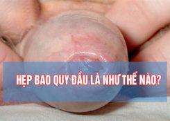 Cách kiểm tra hẹp bao quy đầu ở trẻ