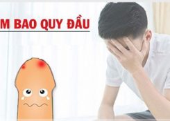 [Bảng giá] Chi phí chữa viêm bao quy đầu bao nhiêu tiền