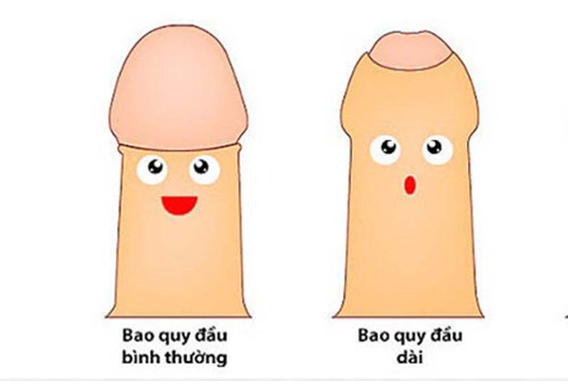 Nguyên nhân tình trạng dài bao quy đầu