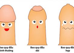 Dấu hiệu nhận biết sớm bệnh hẹp bao quy đầu