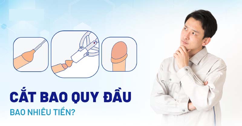 Chi phí cắt bao quy đầu