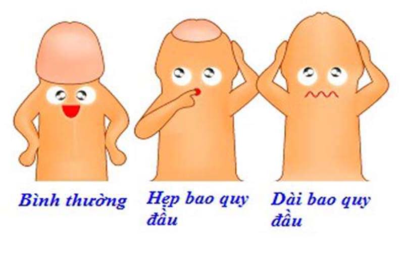 Hẹp bao quy đầu là gì?