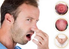 Hẹp bao quy đầu gây mùi hôi xử lý như thế nào