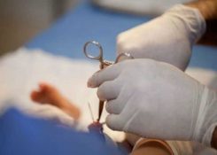 Hẹp bao quy đầu phẫu thuật trong bao lâu