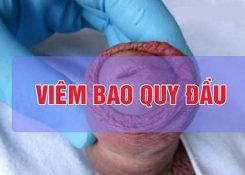 Tổng quan bệnh viêm bao quy đầu: Nguyên nhân và cách điều trị hiệu quả