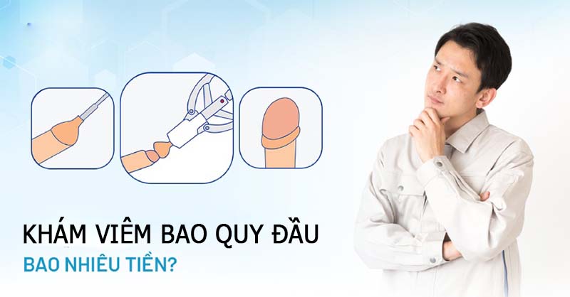 Chi phí phí khám bao quy đầu bao nhiêu tiền