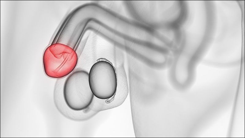 Nguyên nhân gây thâm tím bao quy đầu 