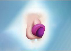 6 nguyên nhân bao quy đầu thâm tím bất thường