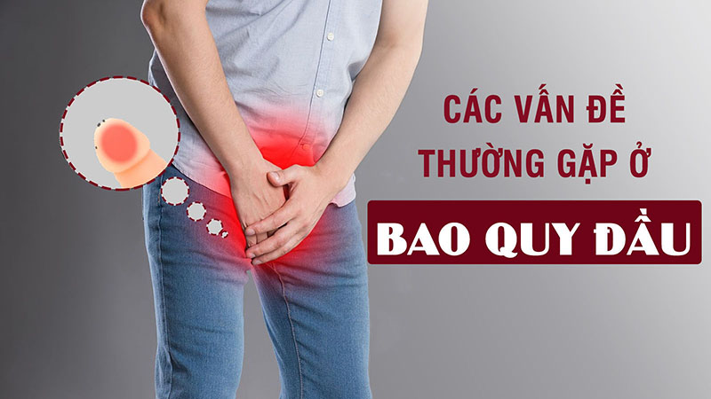 6++ Bệnh bao quy đầu thường gặp ở nam giới