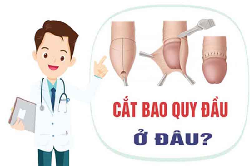 Tiêu chí đánh giá địa chỉ cắt bao quy đầu uy tín tại Hà Nội