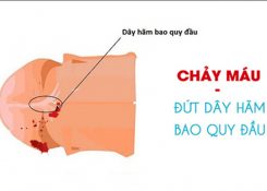 Bị đứt dây hãm bao quy đầu có sao không? Xử lý như thế nào?