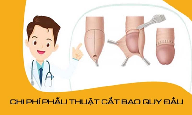 Chi phí thuốc men, chăm sóc sau tiểu phẫu