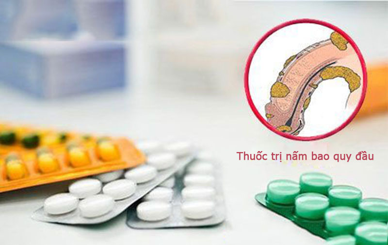 Cách chữa trị nấm bao quy đầu bắng thuốc