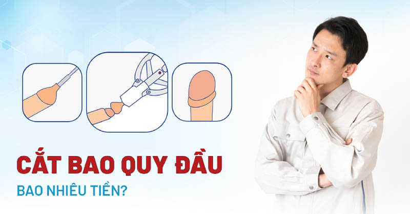 Tư vấn chi phí cắt bao quy đầu