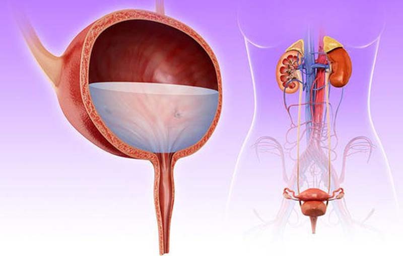 Viêm đường tiết niệu là gì?