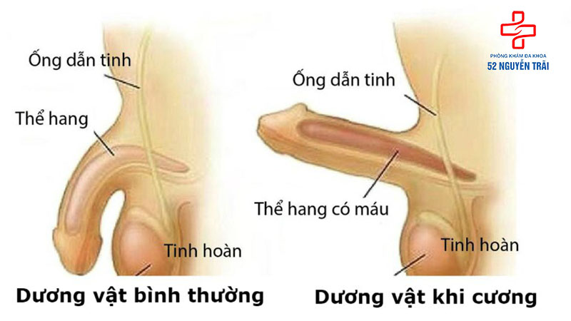 Nguyên nhân gây ra tình trạng cương nhiều lần trong ngày 