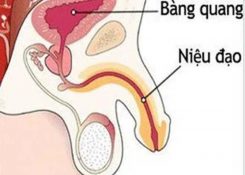 Đau buốt lỗ sáo sau khi quan hệ là dấu hiệu bệnh gì?