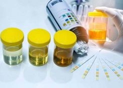 Những điều cần biết về nhiễm trùng đường tiết niệu