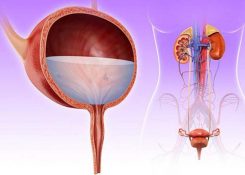 Viêm đường tiết niệu: nguyên nhân triệu chứng và cách điều trị