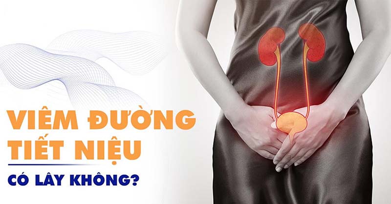 Bệnh viêm đường tiết niệu có lây không?