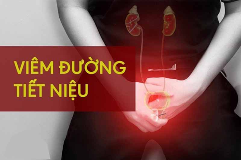 Xử lý đúng cách khi bị viêm đường tiết niệu