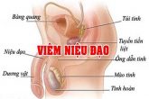 Bệnh viêm niệu đạo có tự khỏi được không?