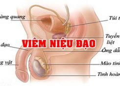 Viêm niệu đạo: Nguyên nhân, triệu chứng, cách điều trị hiệu quả