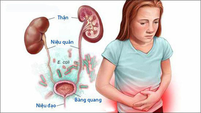 Nguyên nhân gây ra viêm niệu đạo nữ? 