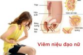 Dấu hiệu nhận biết bệnh viêm niệu đạo ở nữ