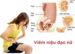 Dấu hiệu nhận biết bệnh viêm niệu đạo ở nữ