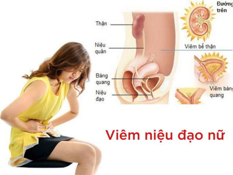 Dấu hiệu viêm niệu đạo nữ