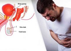 Dấu hiệu nhiễm trùng đường tiểu và phương pháp điều trị