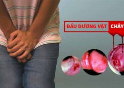 Dương vật chảy máu sau quan hệ có sao không?