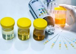 Viêm đường tiểu: Nguyên nhân, dấu hiệu và điều trị