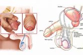 Phân biệt viêm niệu đạo và viêm đường tiết niệu