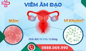 Phân biệt viêm âm đạo do nấm, Gardnerella và trực khuẩn Gram