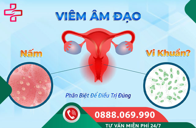 Cách phân biệt nhanh 3 loại viêm âm đạo