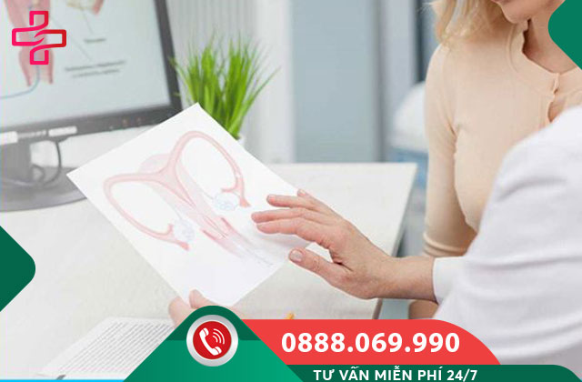 Cách phòng ngừa viêm lộ tuyến cổ tử cung