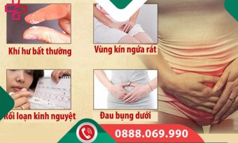 7 dấu hiệu viêm âm đạo điển hình chị em tuyệt đối không nên lờ đi