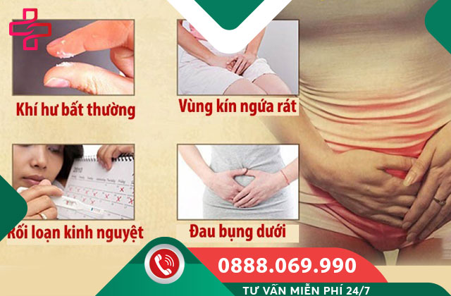 Dấu hiệu viêm âm đạo dễ nhận biết