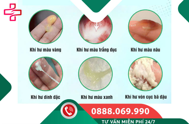 Khí hư ra nhiều bất thường