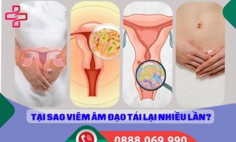 Tại sao viêm âm đạo tái lại nhiều lần và cách xử lý dứt điểm?