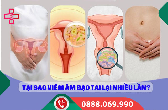 Tại sao viêm âm đạo tái lại nhiều lần?