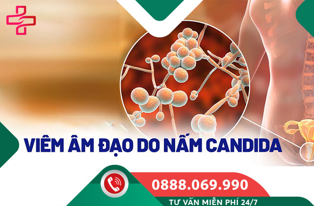 Viêm âm đạo do nấm Candida
