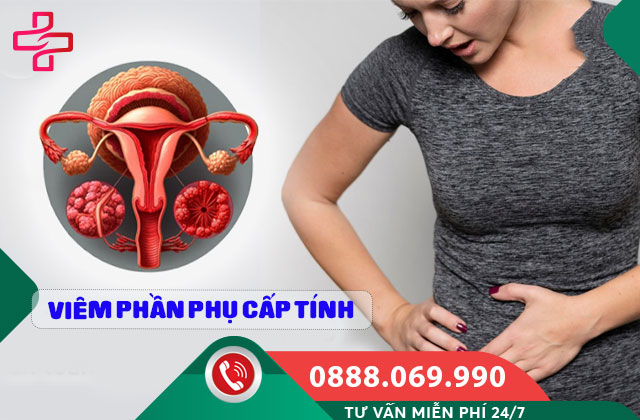 Viêm phần phụ cấp tính