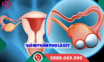 Viêm phần phụ là gì? Nguyên nhân, dấu hiệu và cách điều trị