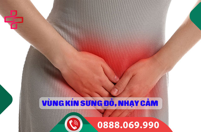 Vùng kín sưng đỏ, nhạy cảm